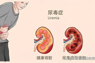 基德：如果我们想要夺冠 我们需要哈达威并且要信任他